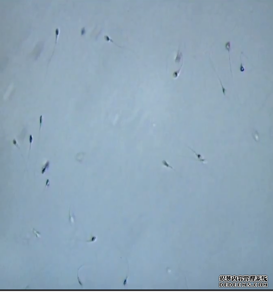 出色的IMSI，精子慢流形态学筛选胞浆内单精子注射技术